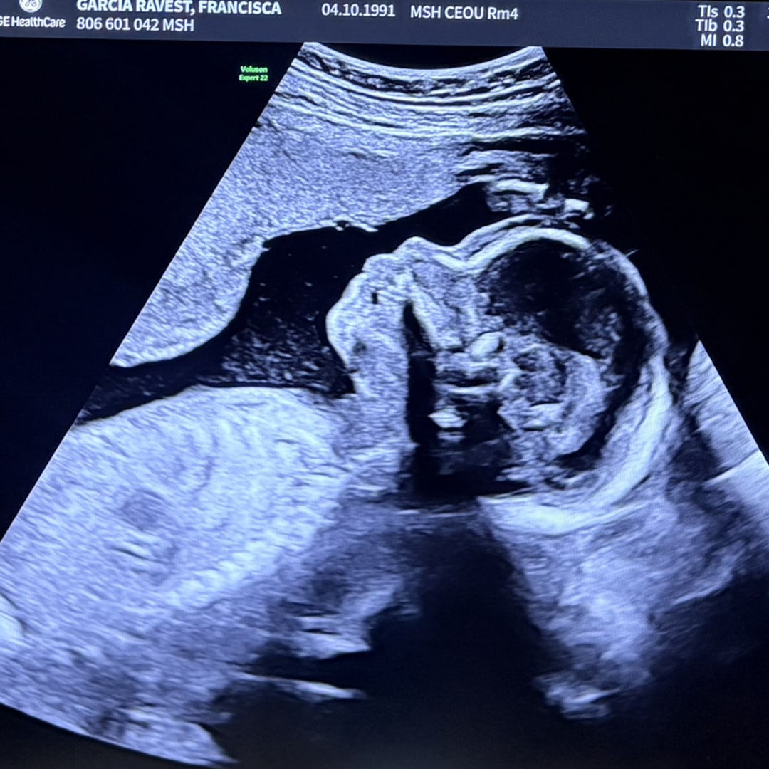 Photo shared by Francisca for their Babylist baby registry.