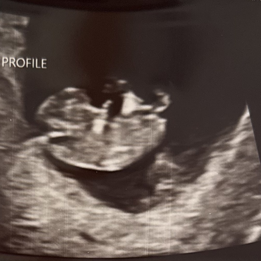 Photo shared by Mya for their Babylist baby registry.