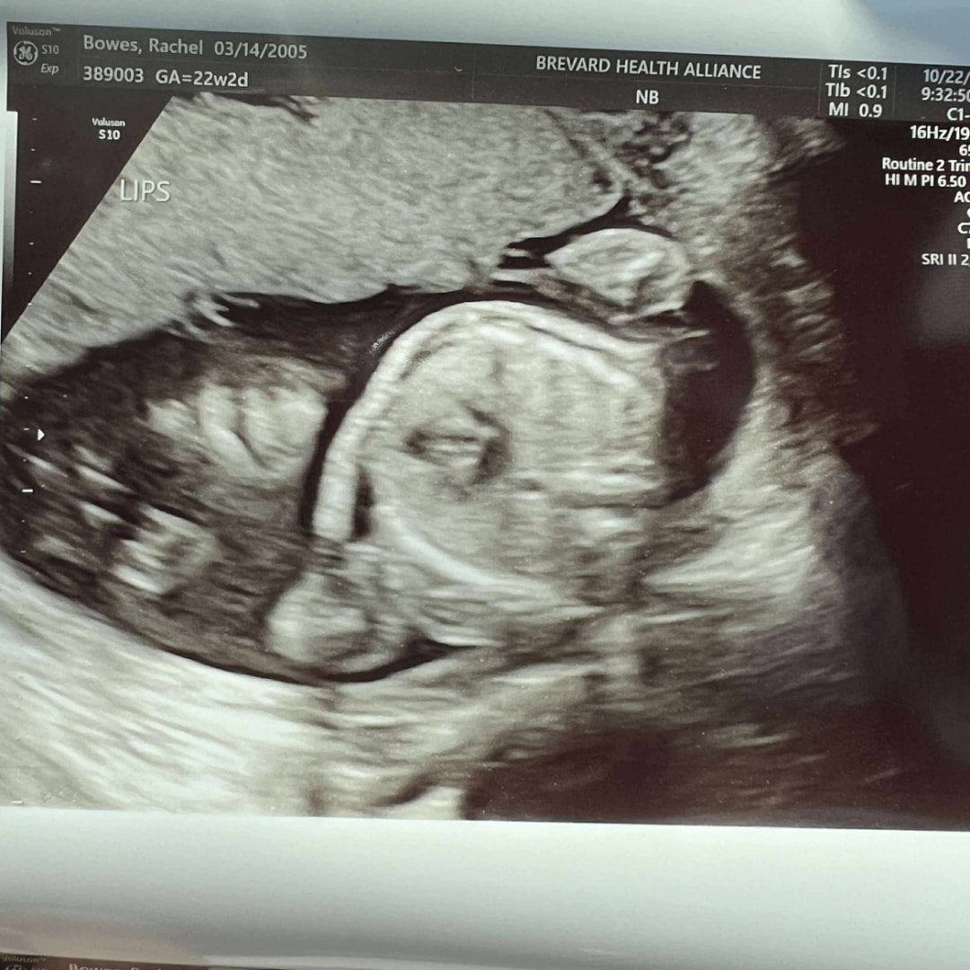 Photo shared by Rachel for their Babylist baby registry.