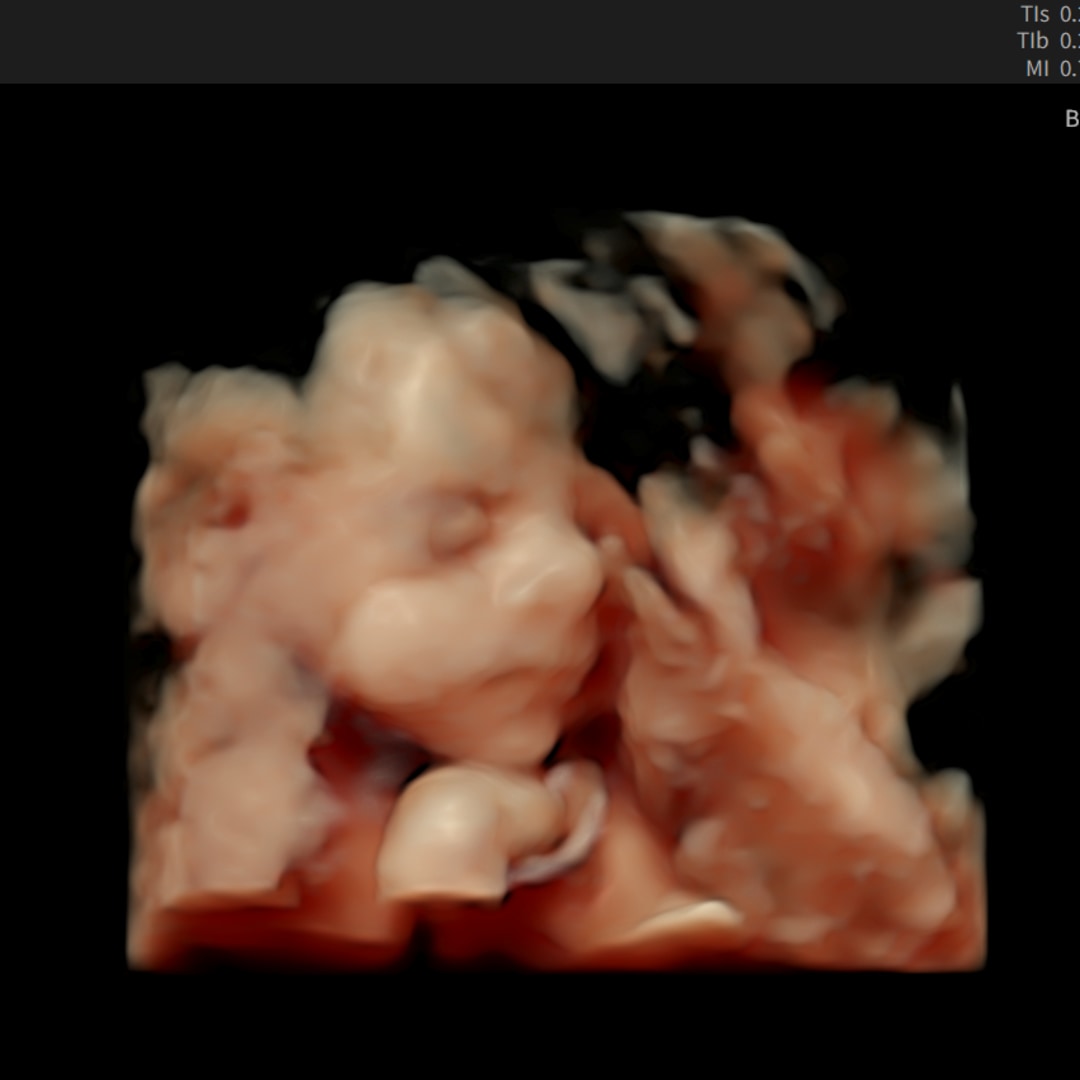 Photo shared by Madison for their Babylist baby registry.