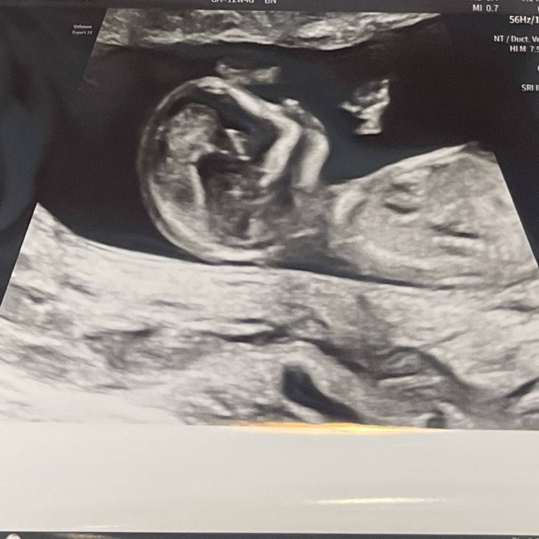 Photo shared by Juliana for their Babylist baby registry.