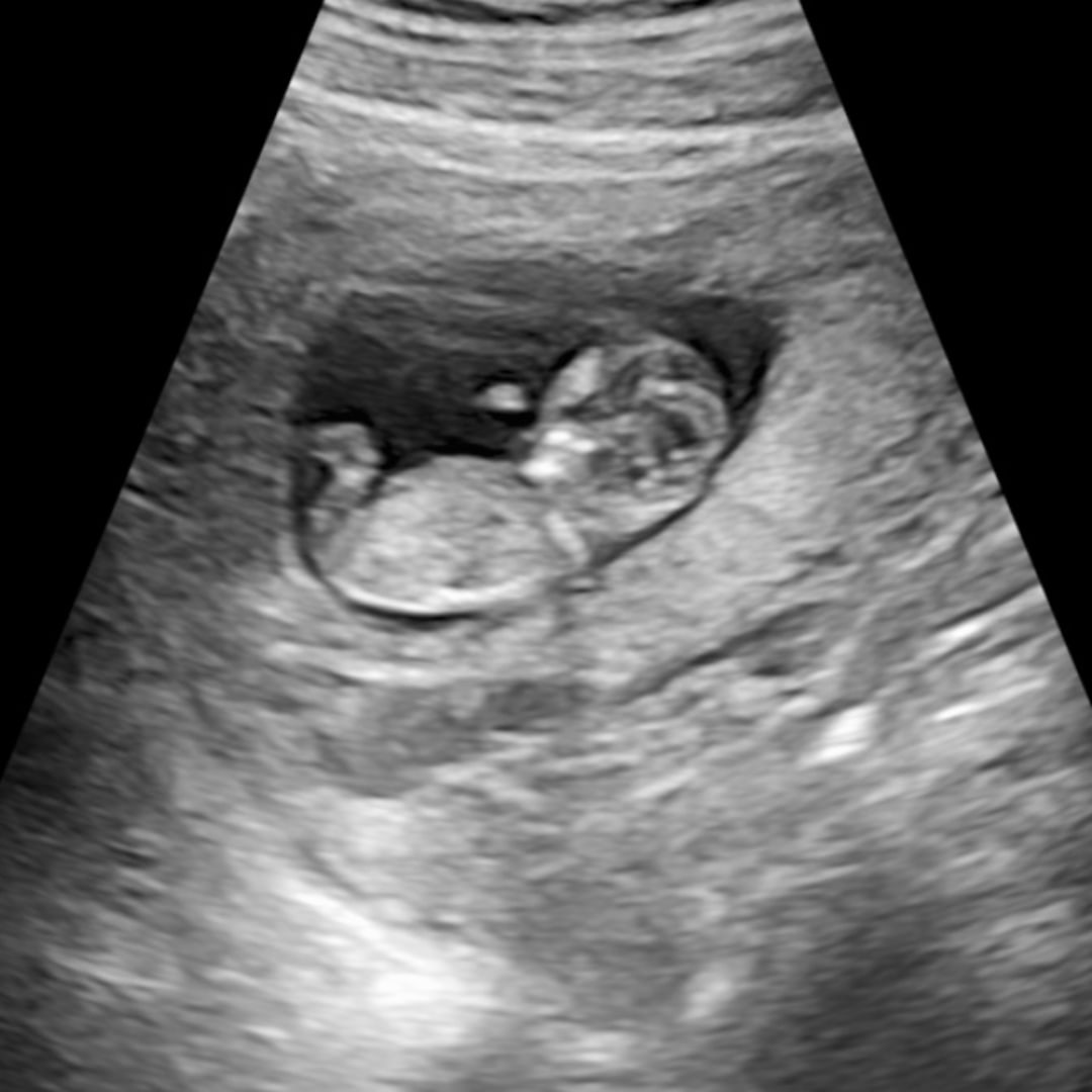 Photo shared by Alex for their Babylist baby registry.