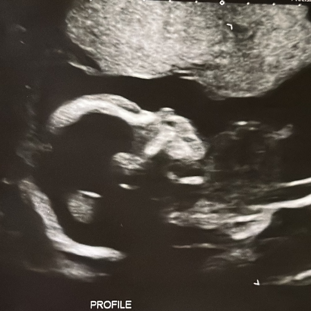 Photo shared by Fern for their Babylist baby registry.