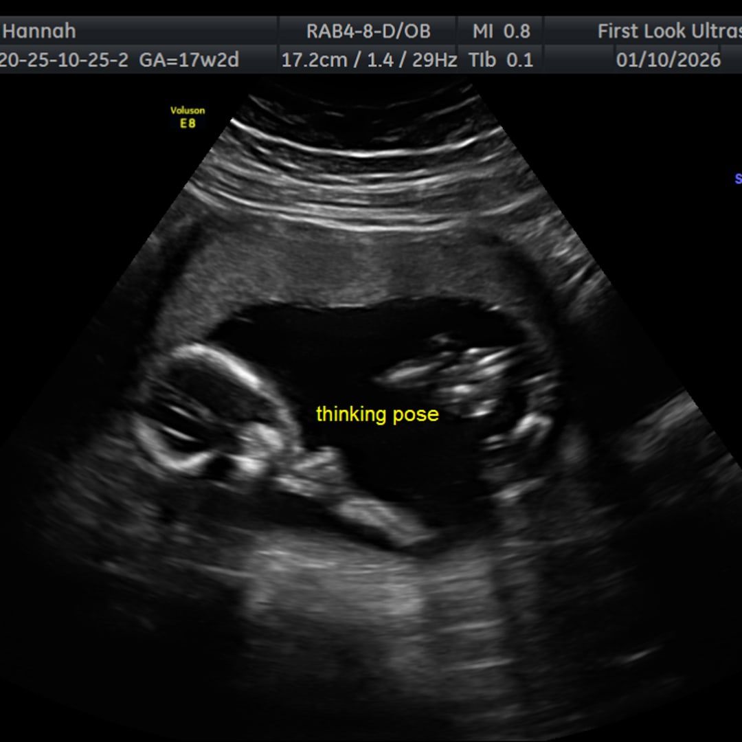 Photo shared by Hannah for their Babylist baby registry.