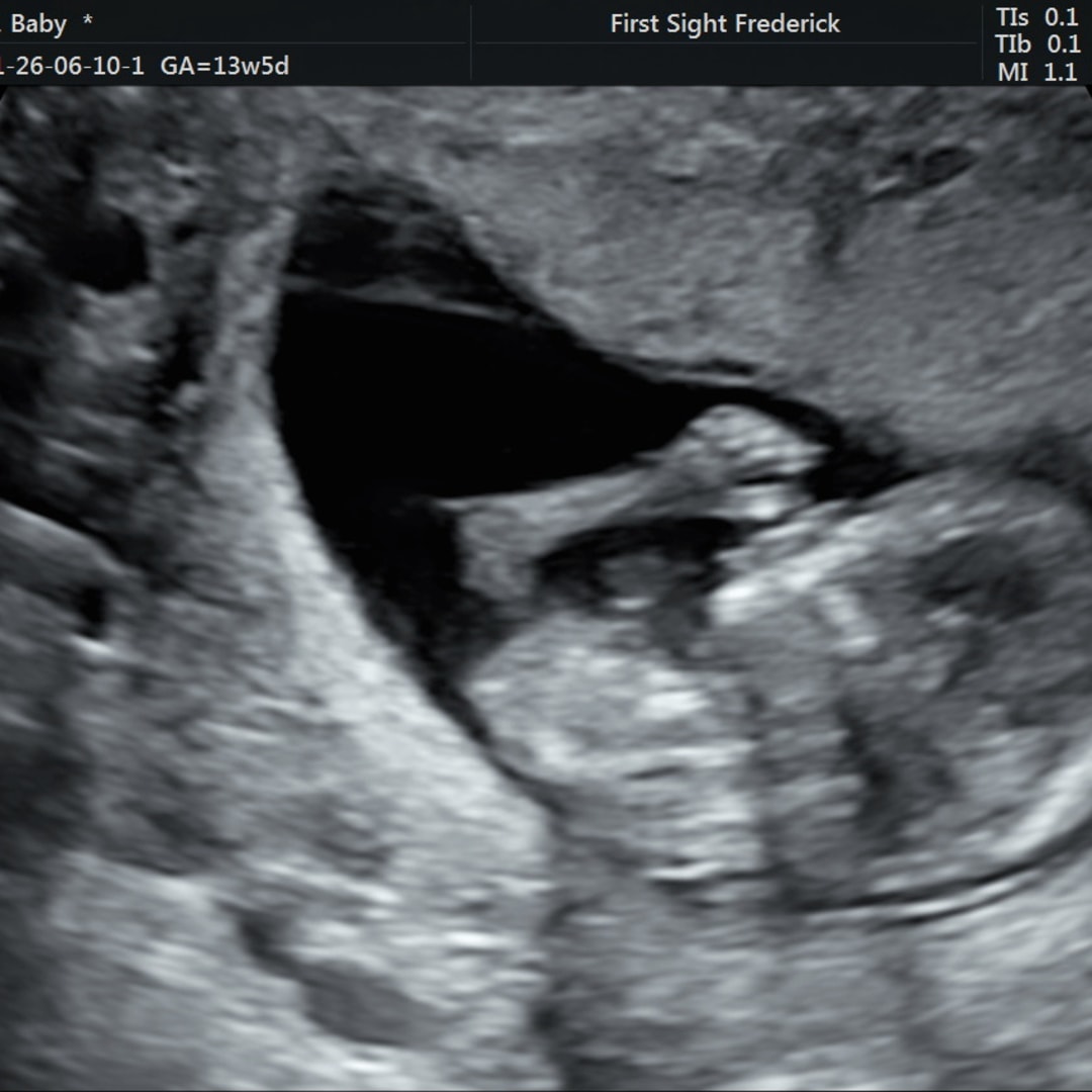 Photo shared by Marisa for their Babylist baby registry.