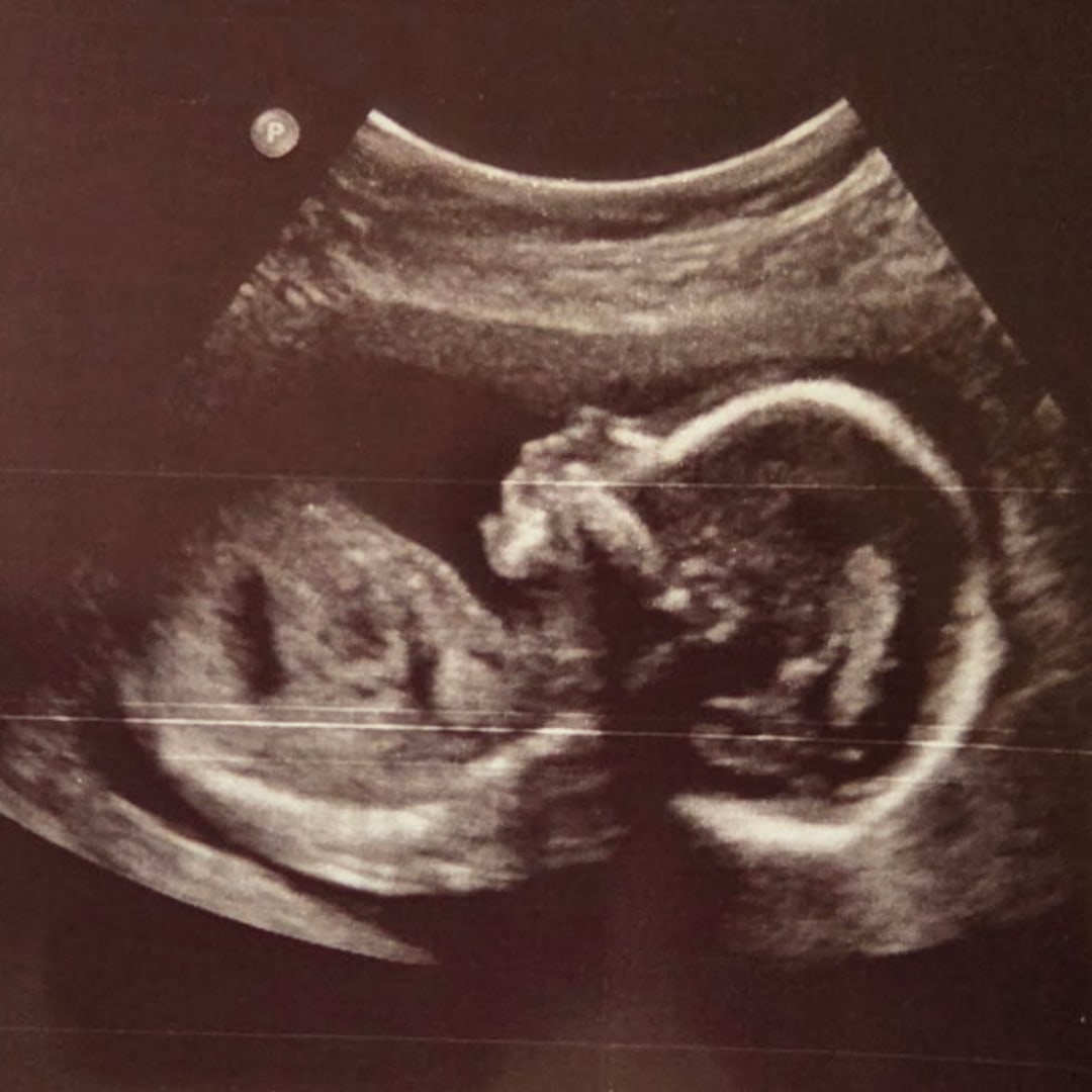 Photo shared by Jessica for their Babylist baby registry.