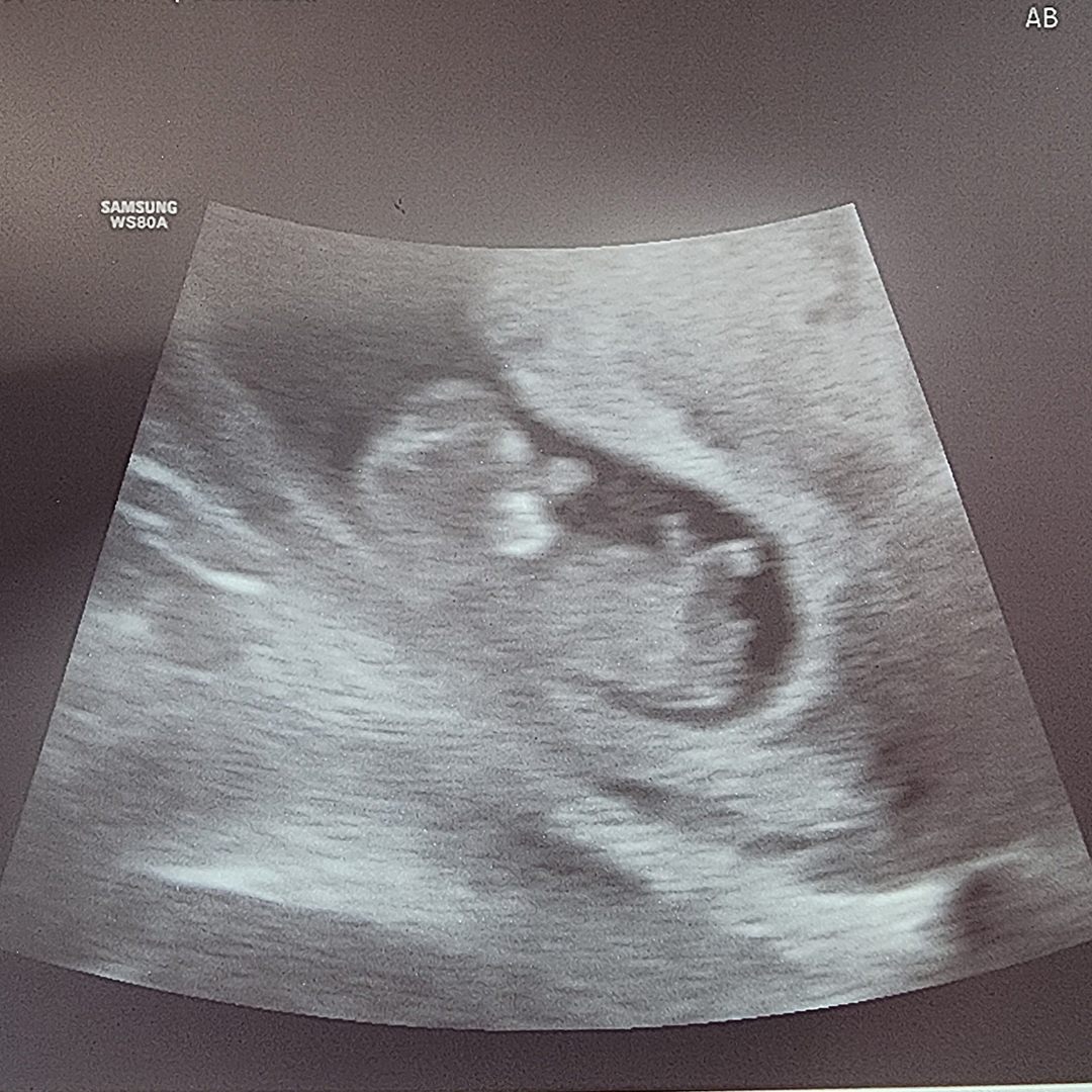 Photo shared by Emily for their Babylist baby registry.