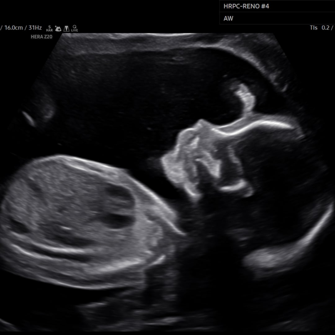 Photo shared by Skye for their Babylist baby registry.