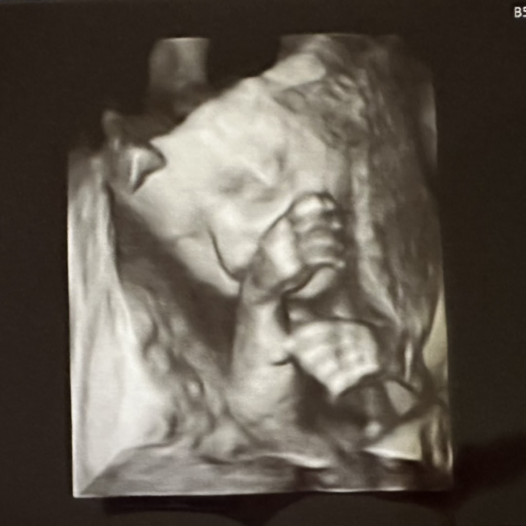 Photo shared by Justine for their Babylist baby registry.