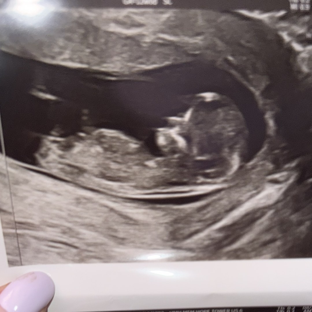 Photo shared by Eda for their Babylist baby registry.