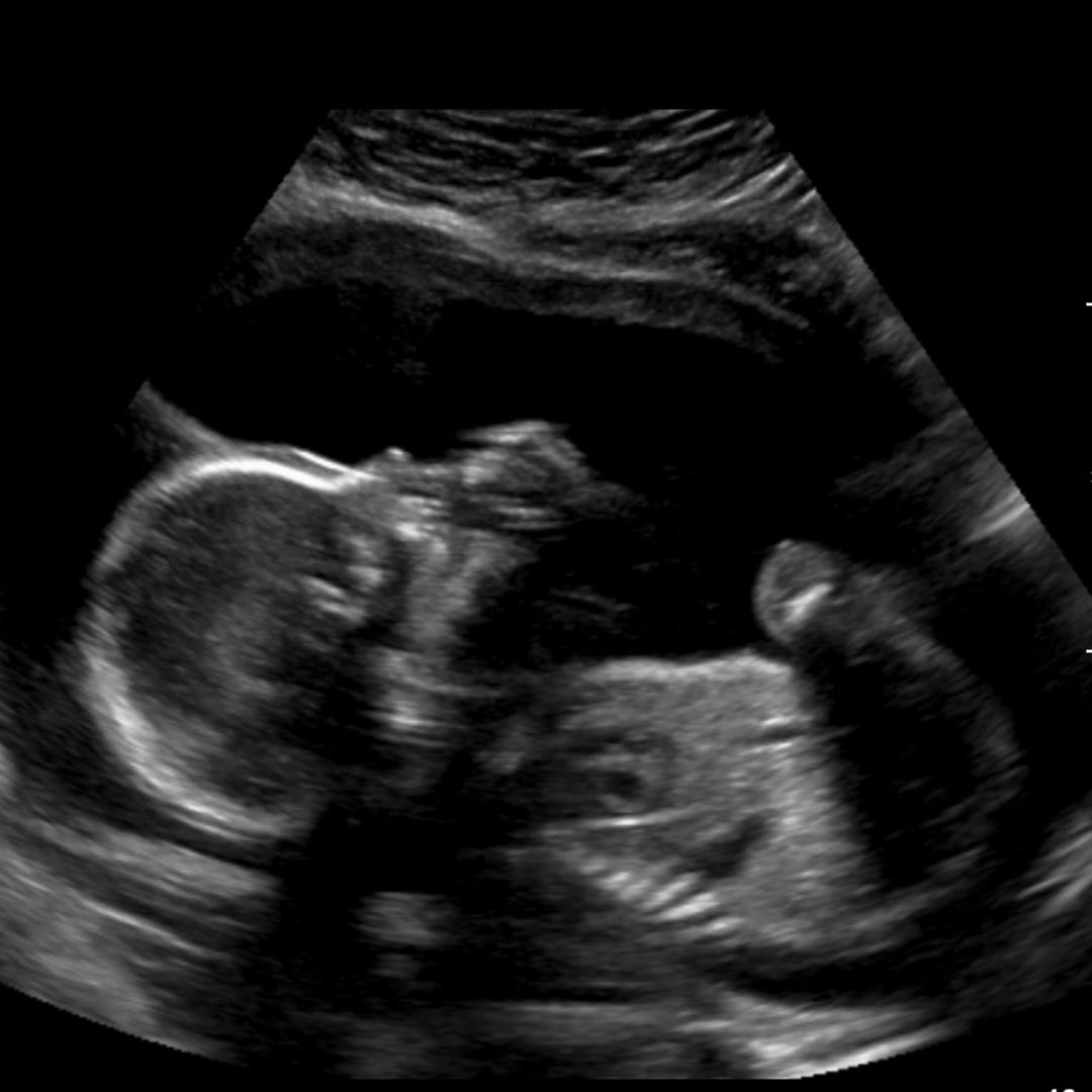 Photo shared by Yvonne for their Babylist baby registry.