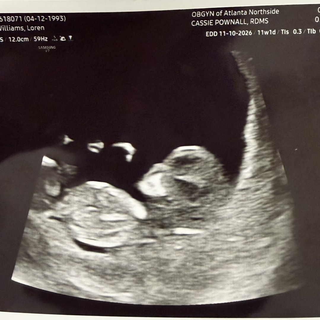 Photo shared by Loren for their Babylist baby registry.