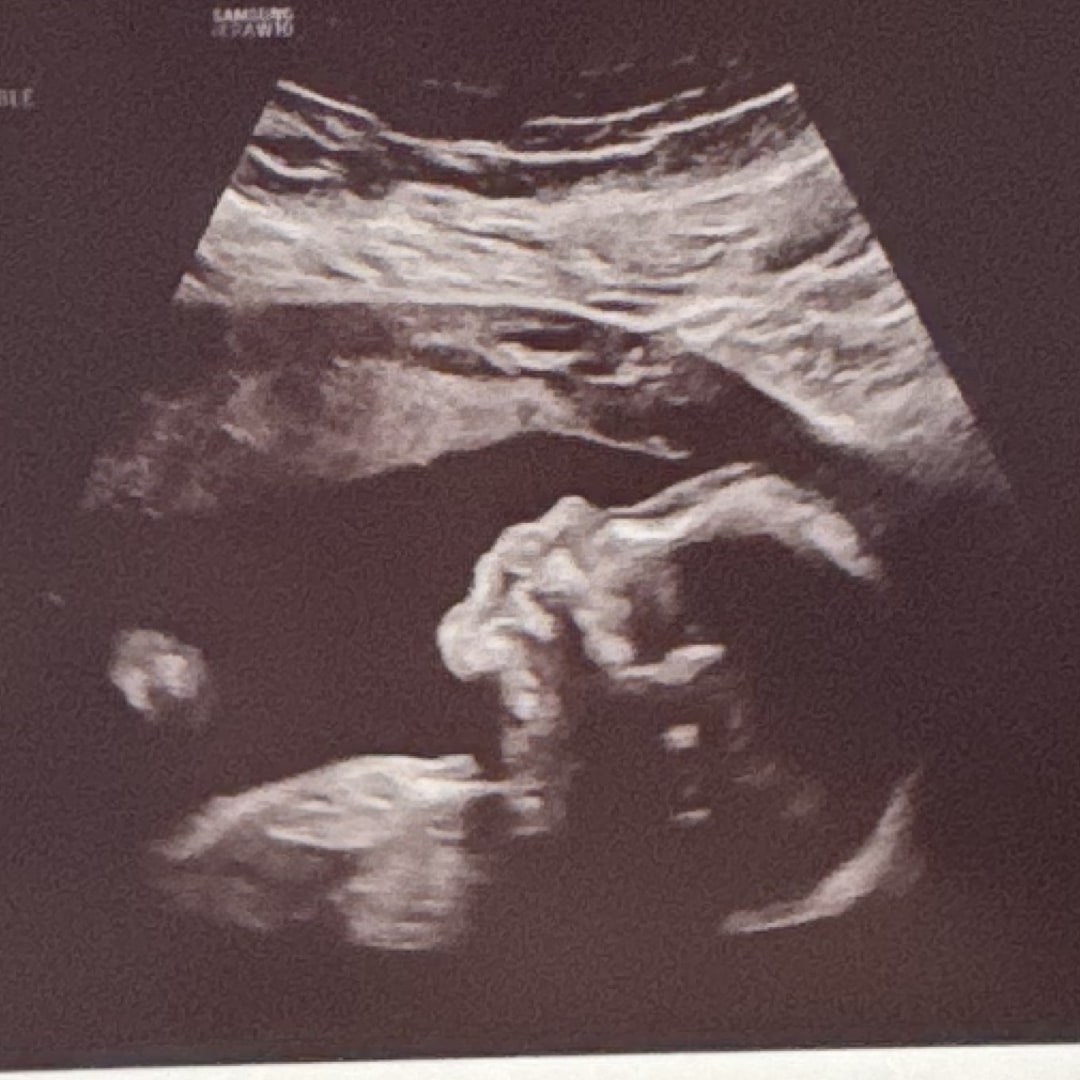 Photo shared by Courtenay for their Babylist baby registry.