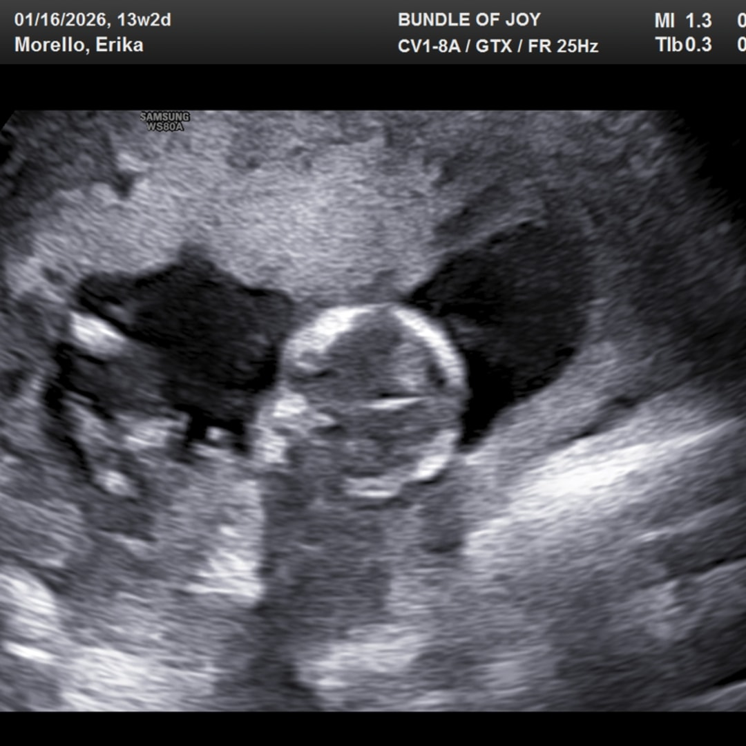 Photo shared by Erika for their Babylist baby registry.