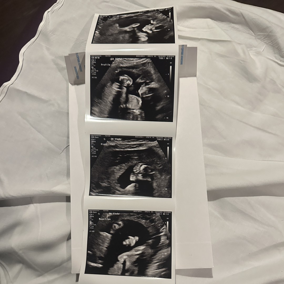 Photo shared by Emmersen for their Babylist baby registry.