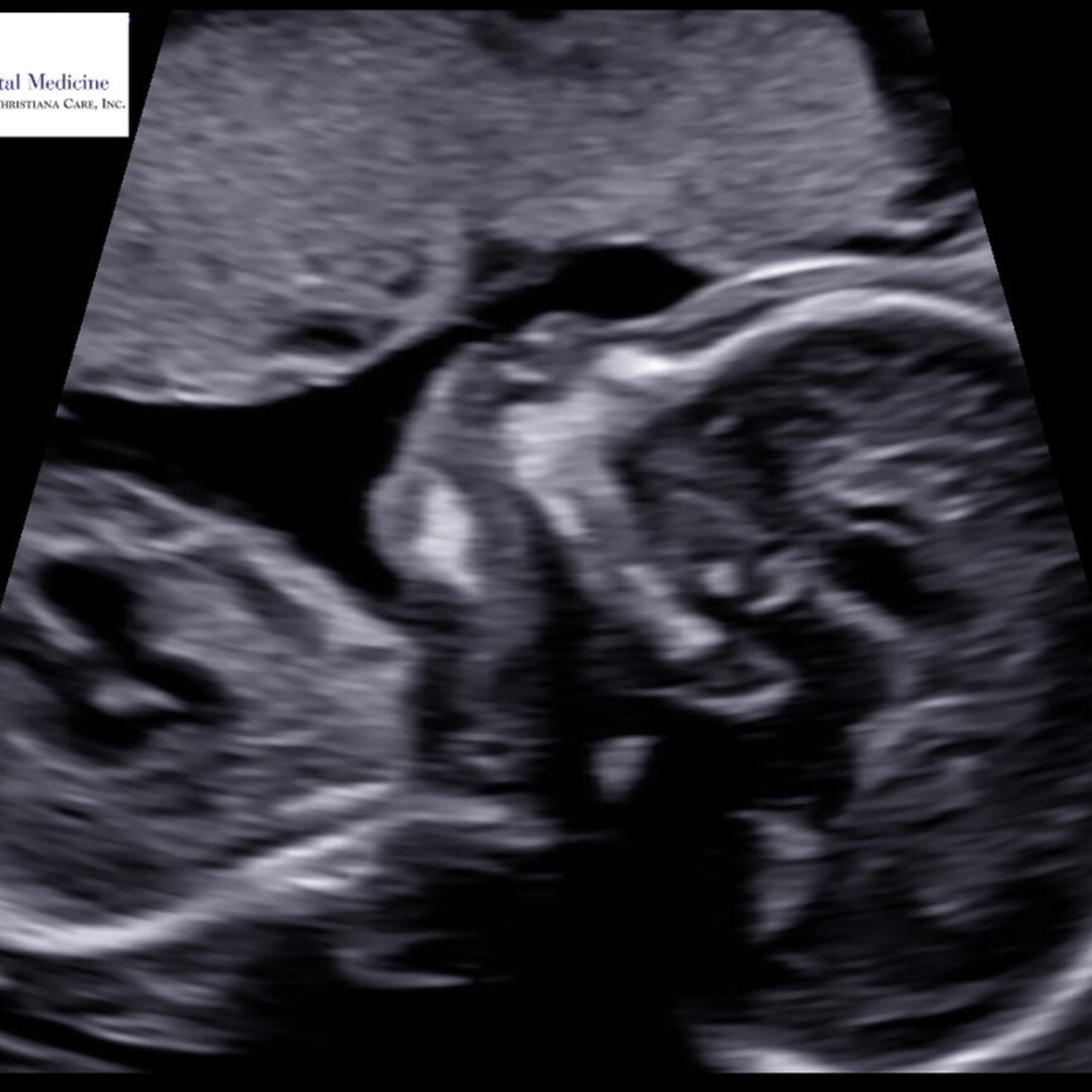 Photo shared by Radhika for their Babylist baby registry.