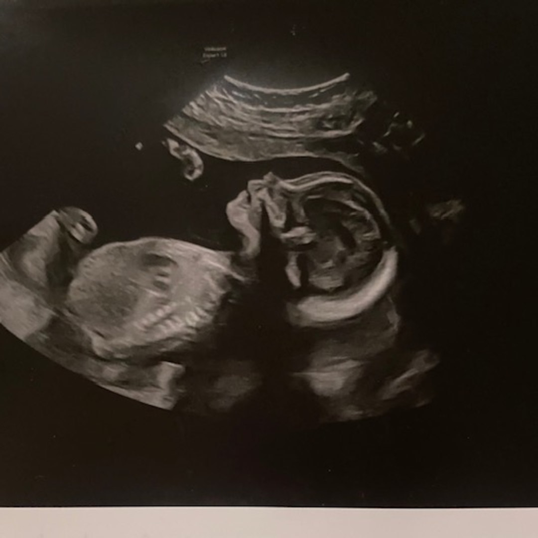 Photo shared by Ivy for their Babylist baby registry.