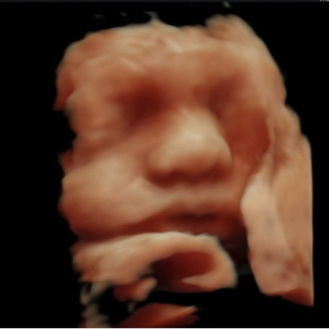 Photo shared by Koryn for their Babylist baby registry.