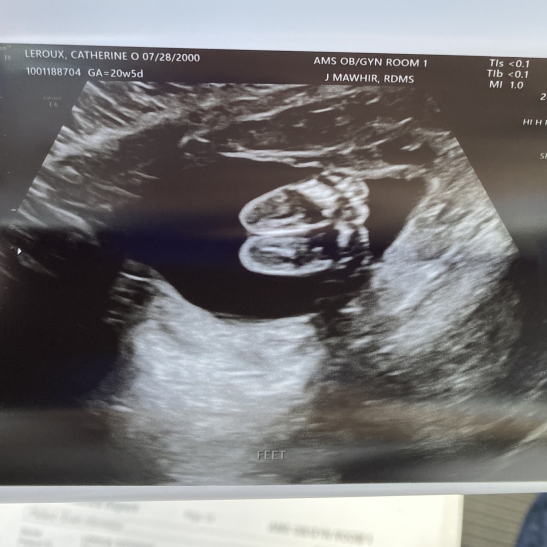 Photo shared by Catherine for their Babylist baby registry.