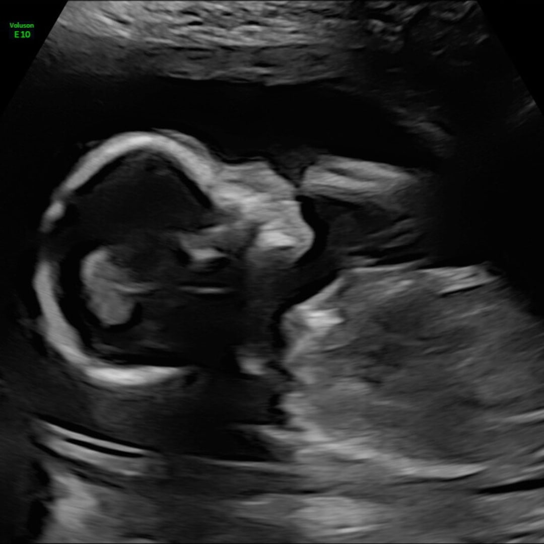 Photo shared by Carli for their Babylist baby registry.
