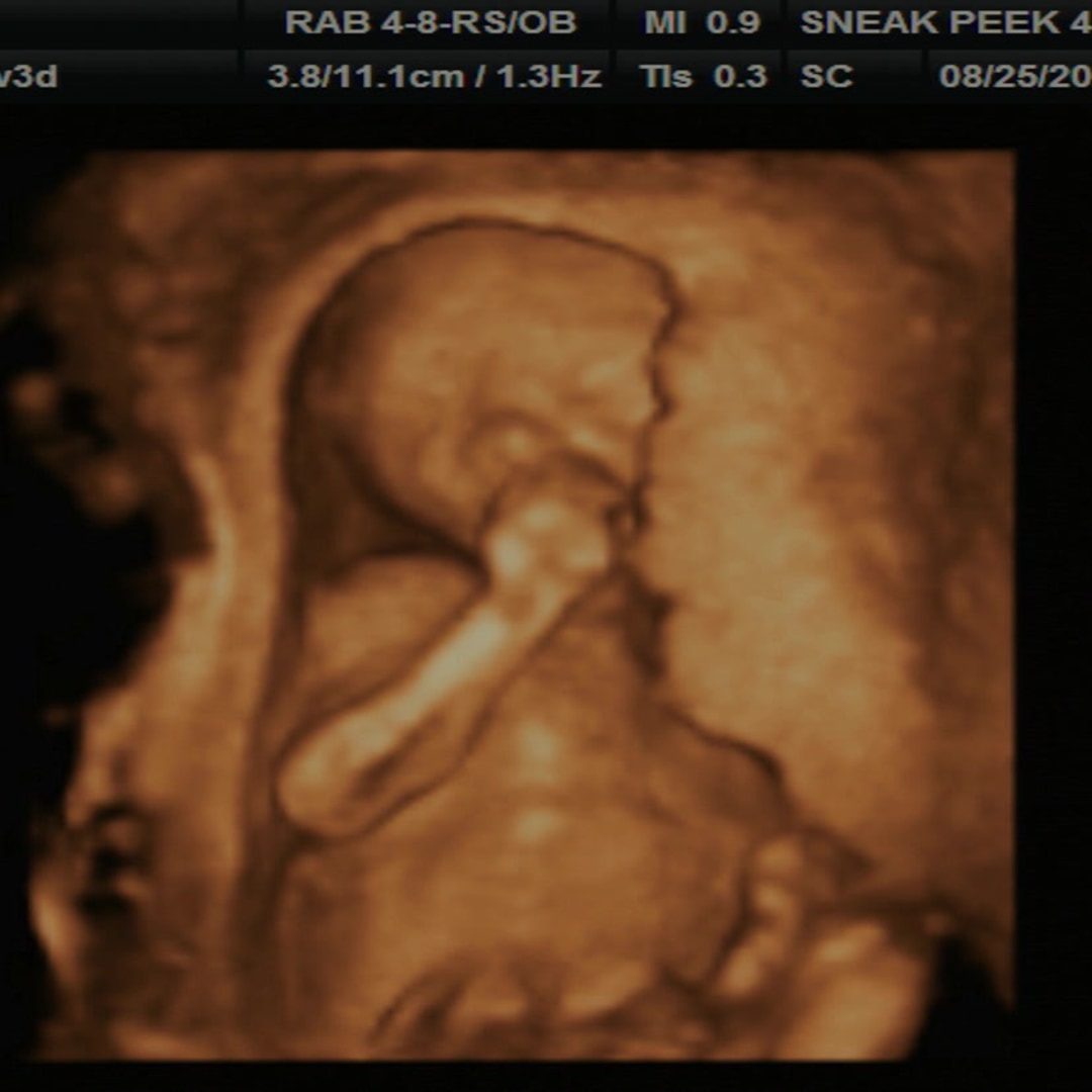 Photo shared by Allie for their Babylist baby registry.