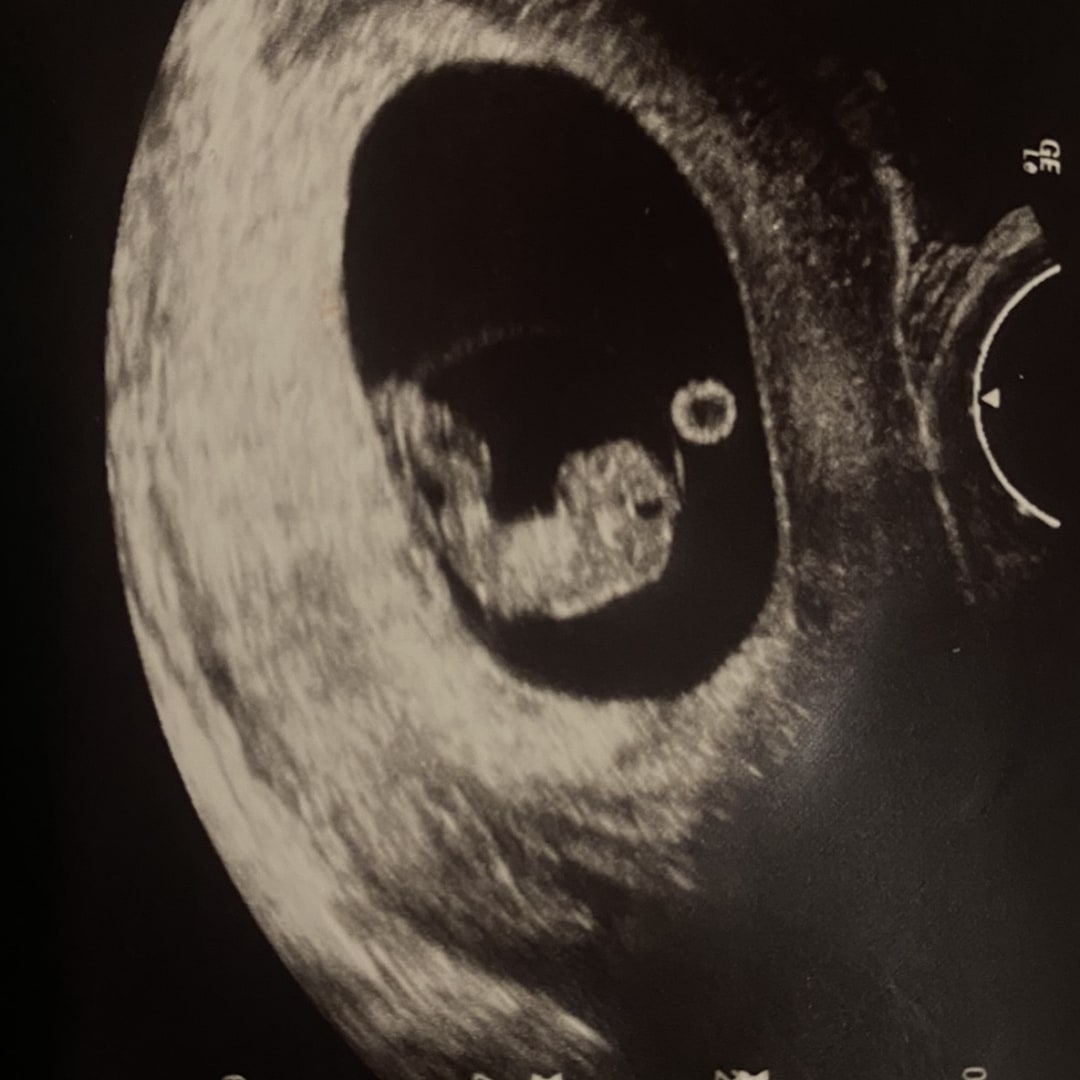 Photo shared by Cindy for their Babylist baby registry.