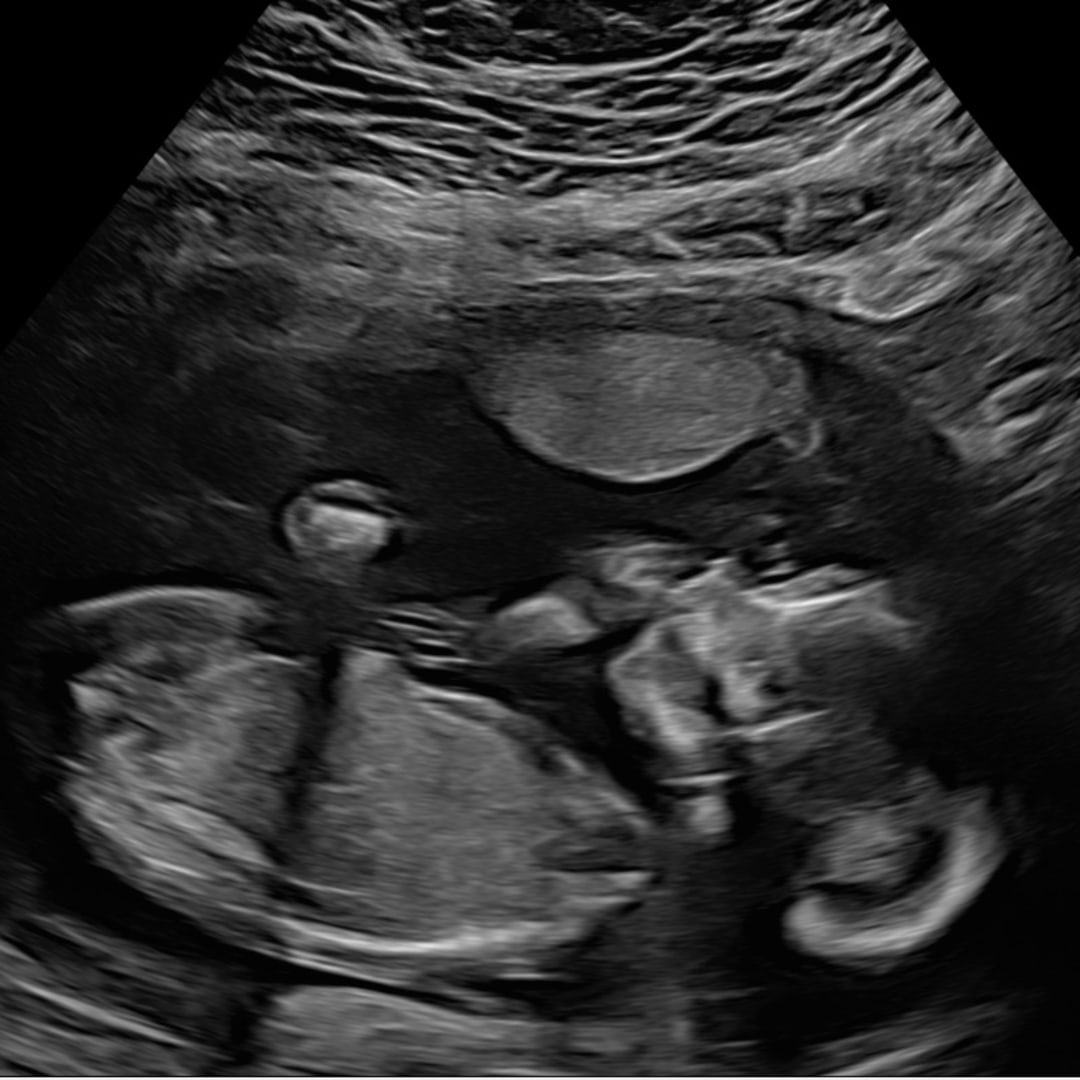 Photo shared by Hannah for their Babylist baby registry.