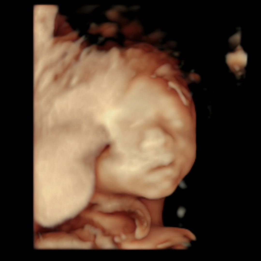 Photo shared by Sally for their Babylist baby registry.