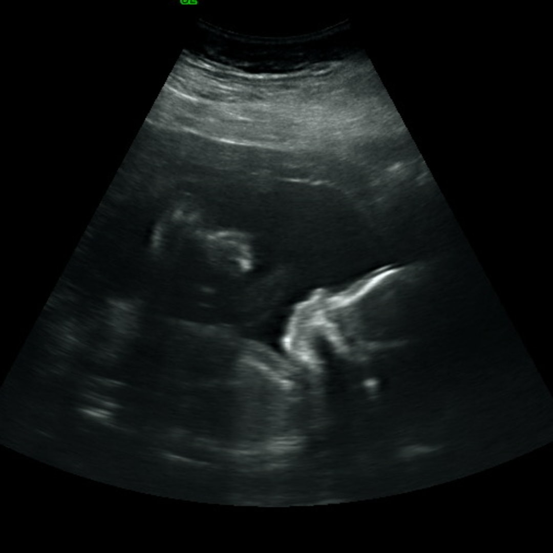 Photo shared by Chatney for their Babylist baby registry.