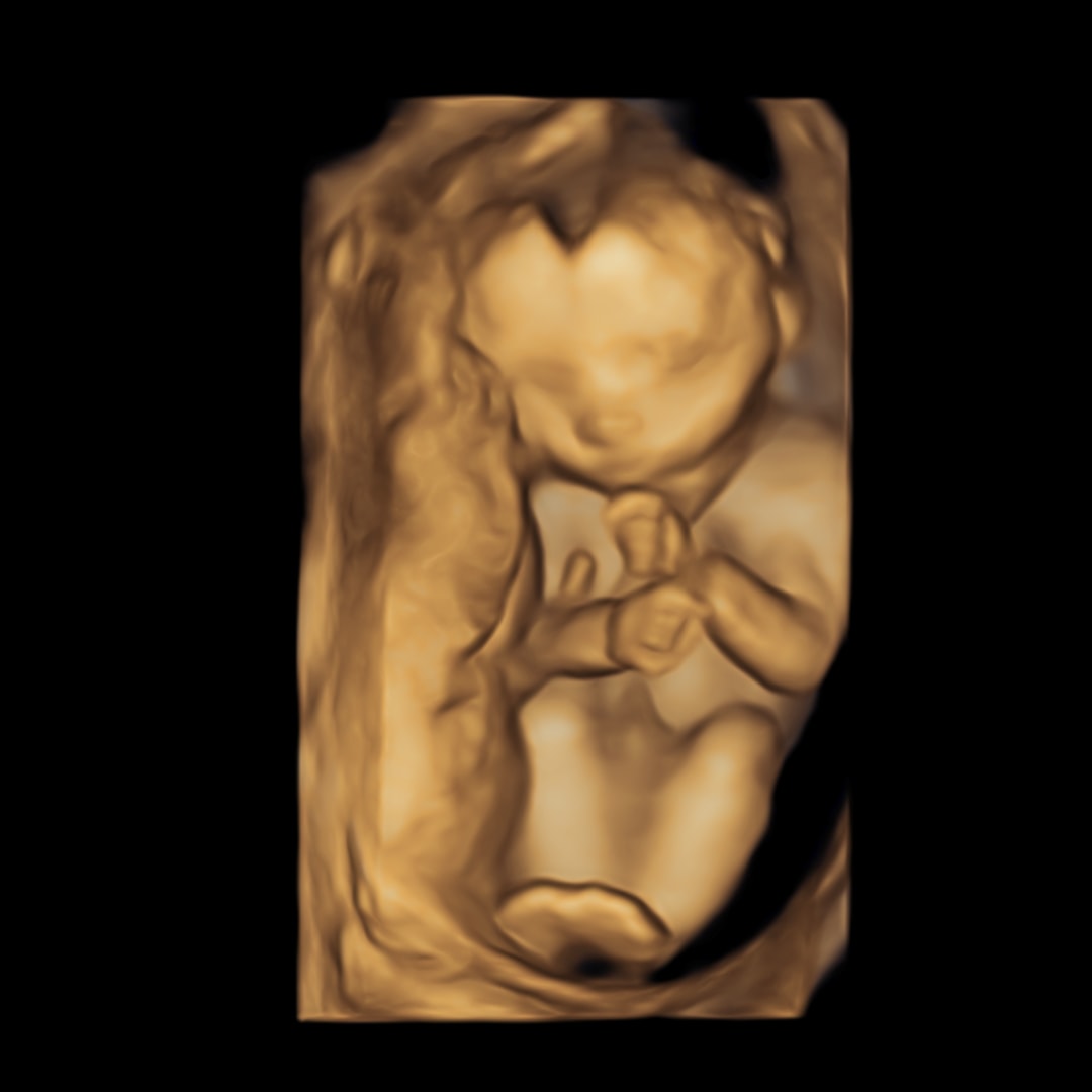 Photo shared by Casey for their Babylist baby registry.