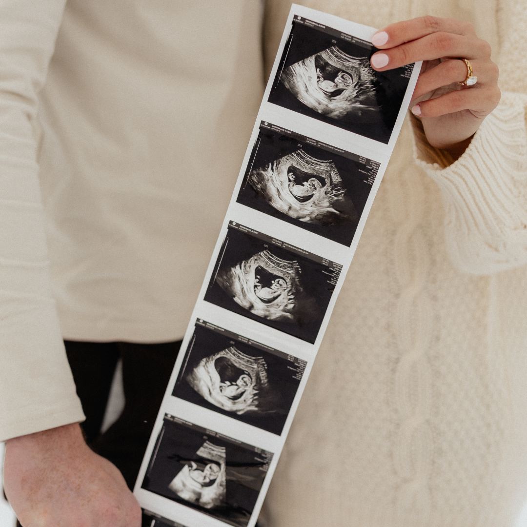 Photo shared by Alexis for their Babylist baby registry.