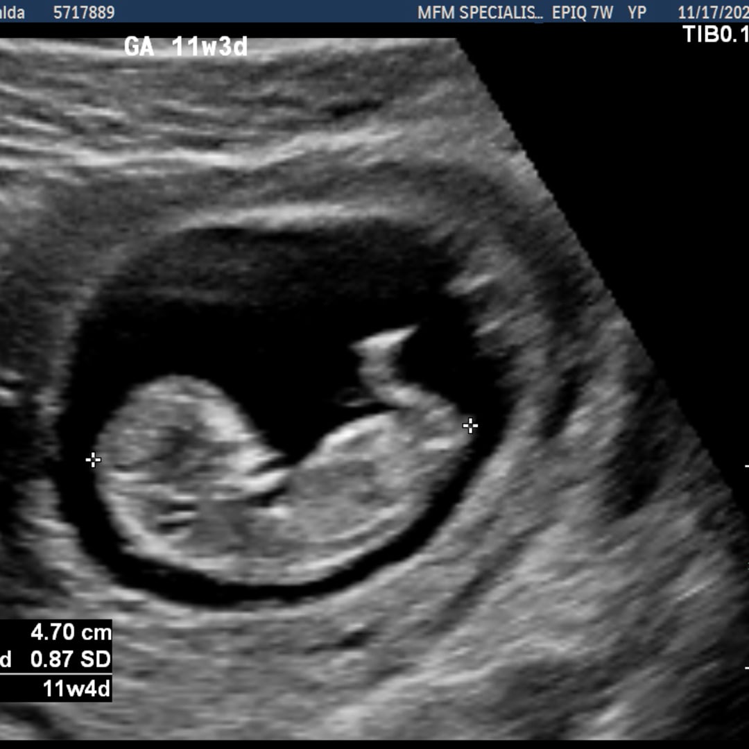 Photo shared by Esme for their Babylist baby registry.