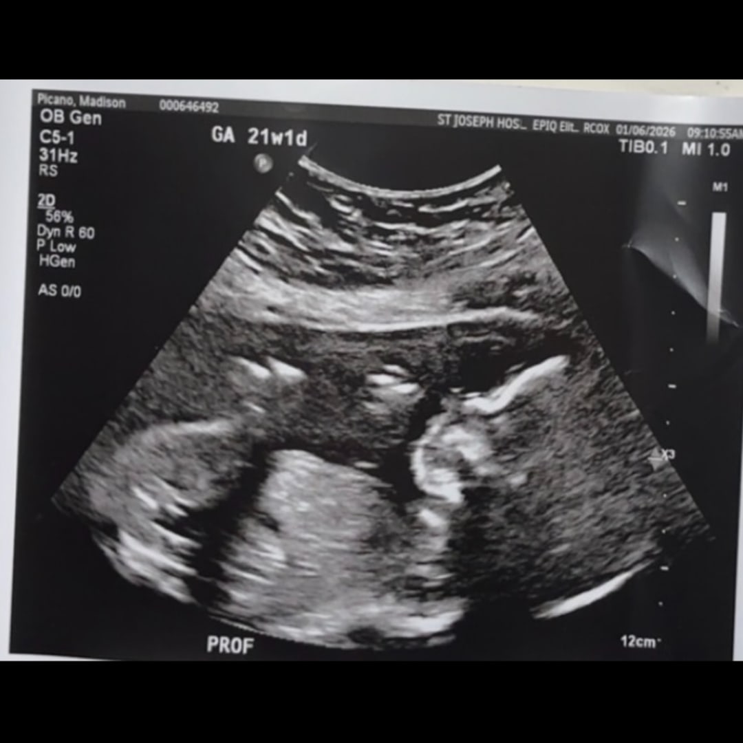 Photo shared by Nick for their Babylist baby registry.