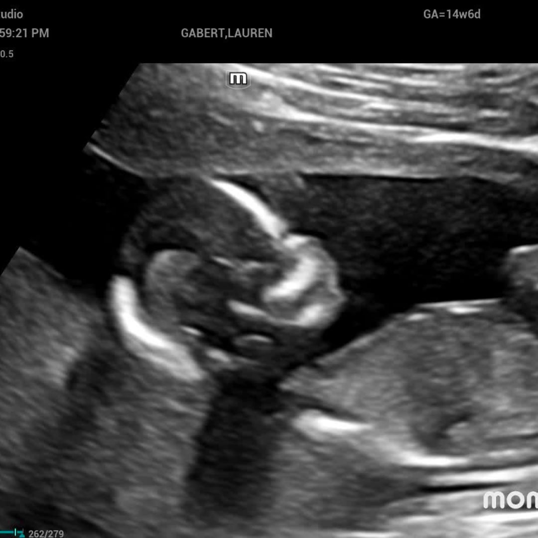 Photo shared by Lauren for their Babylist baby registry.