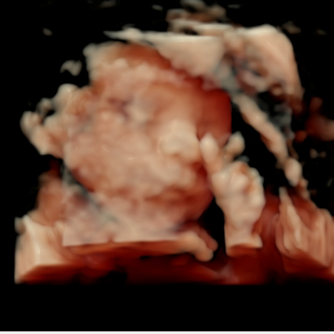 Photo shared by Jay for their Babylist baby registry.