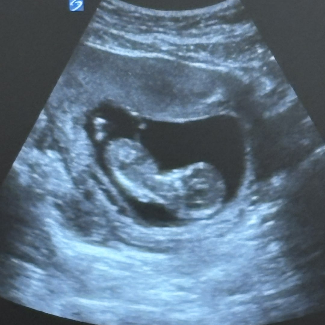Photo shared by Zach for their Babylist baby registry.