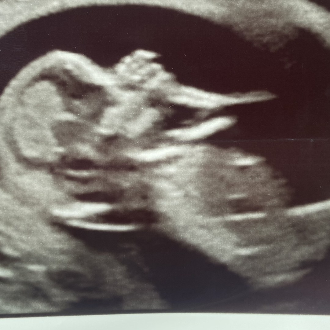 Photo shared by Emily for their Babylist baby registry.