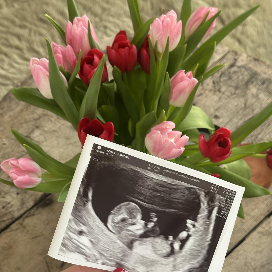 Photo shared by Jackie for their Babylist baby registry.