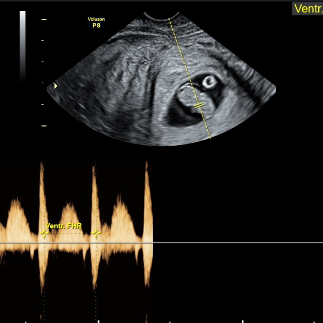 Photo shared by Cassidy for their Babylist baby registry.