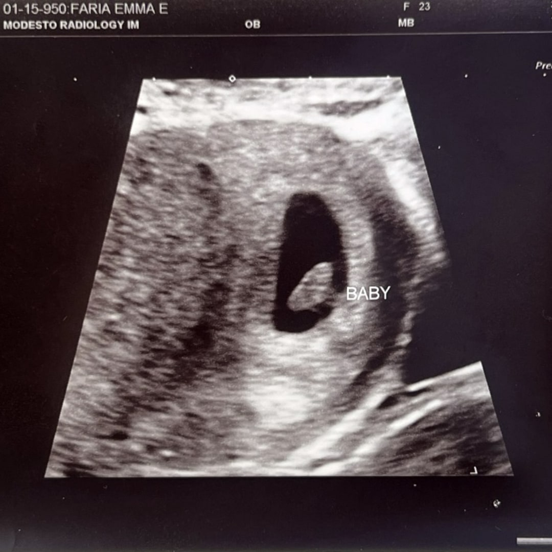 Photo shared by Emma for their Babylist baby registry.