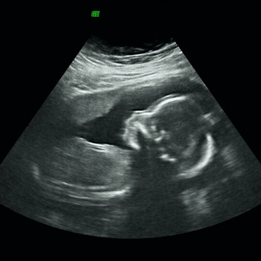 Photo shared by Hayden for their Babylist baby registry.