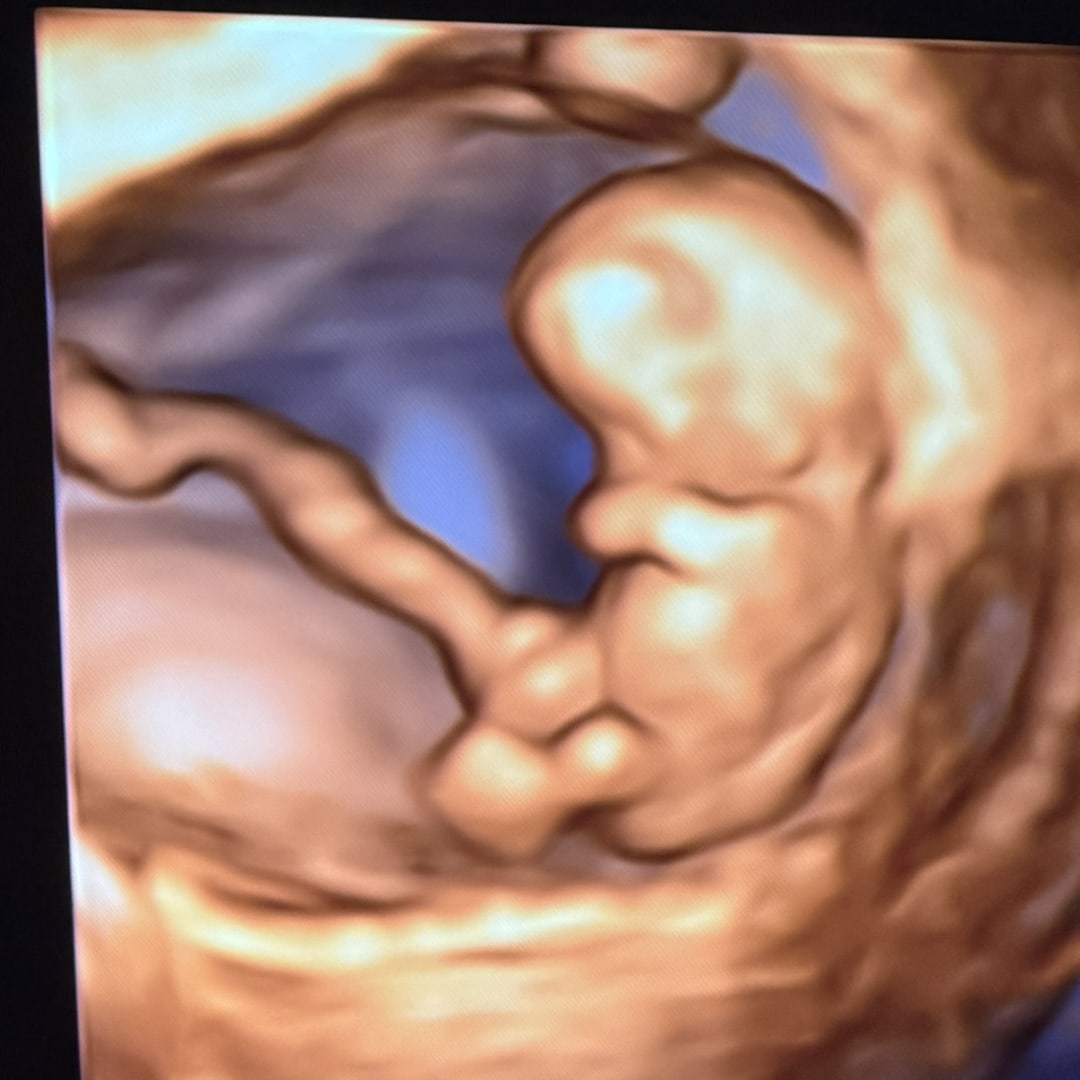 Photo shared by Payton for their Babylist baby registry.