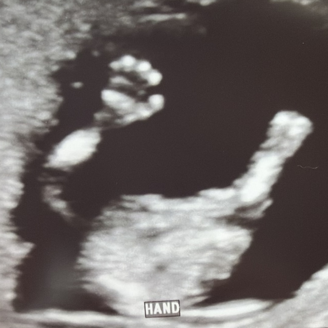Photo shared by Izabella for their Babylist baby registry.