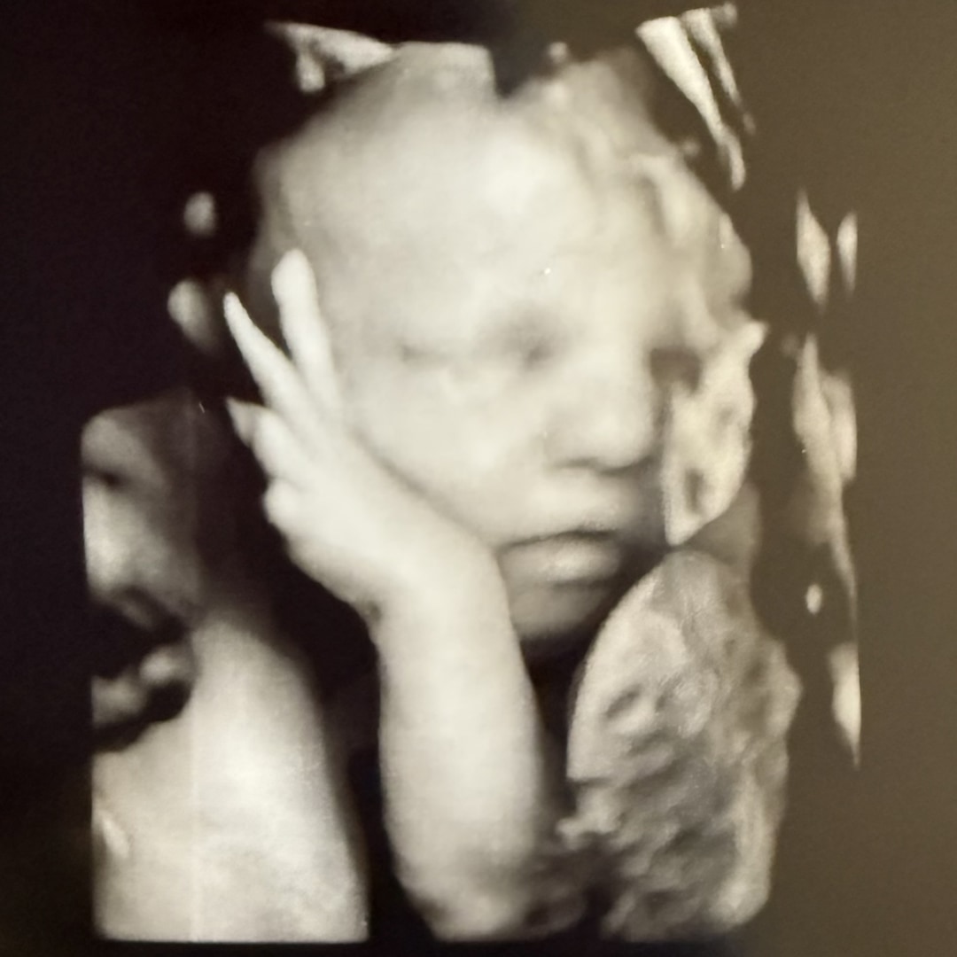 Photo shared by Allysa for their Babylist baby registry.