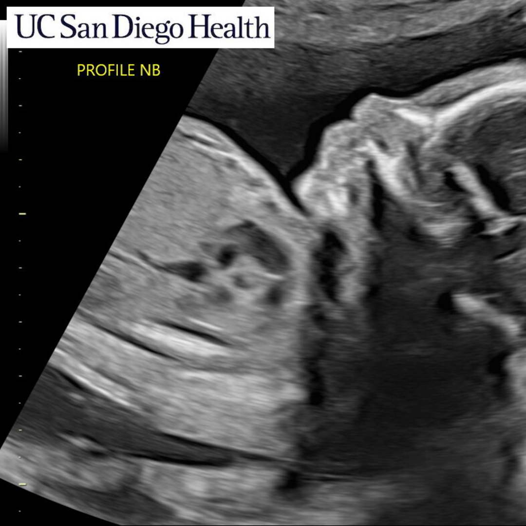 Photo shared by Rose for their Babylist baby registry.