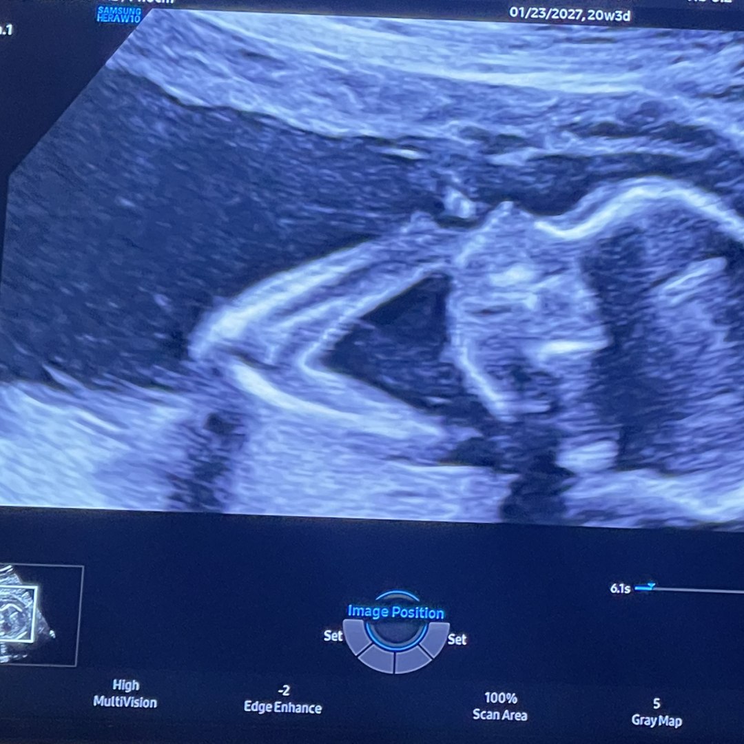 Photo shared by Josephine for their Babylist baby registry.