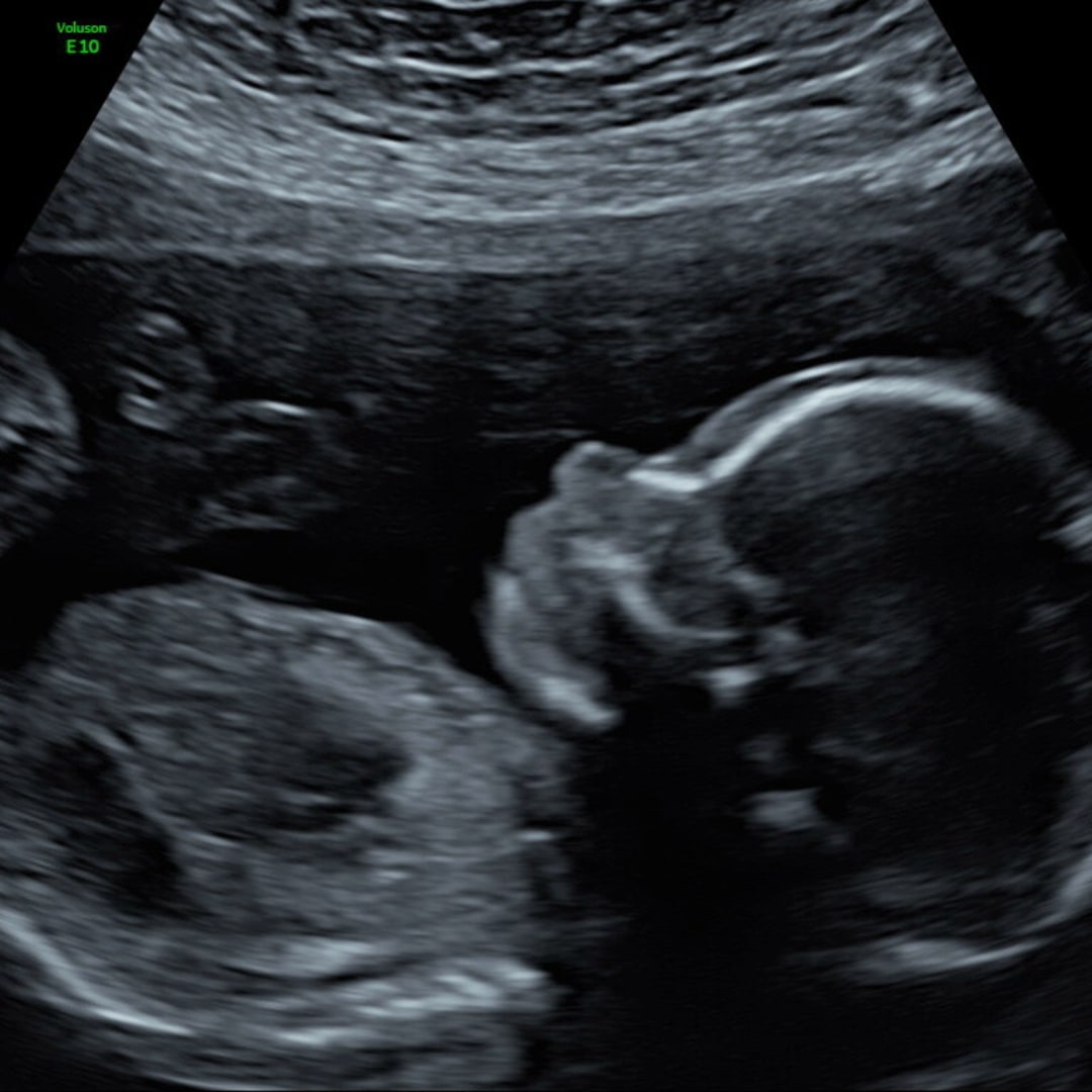 Photo shared by Jenna for their Babylist baby registry.