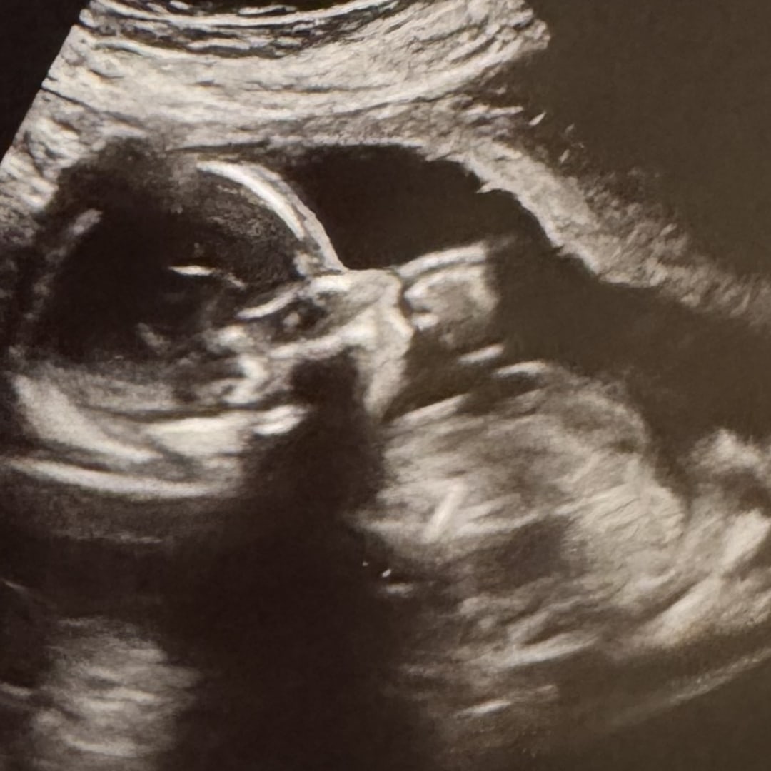 Photo shared by Emily for their Babylist baby registry.