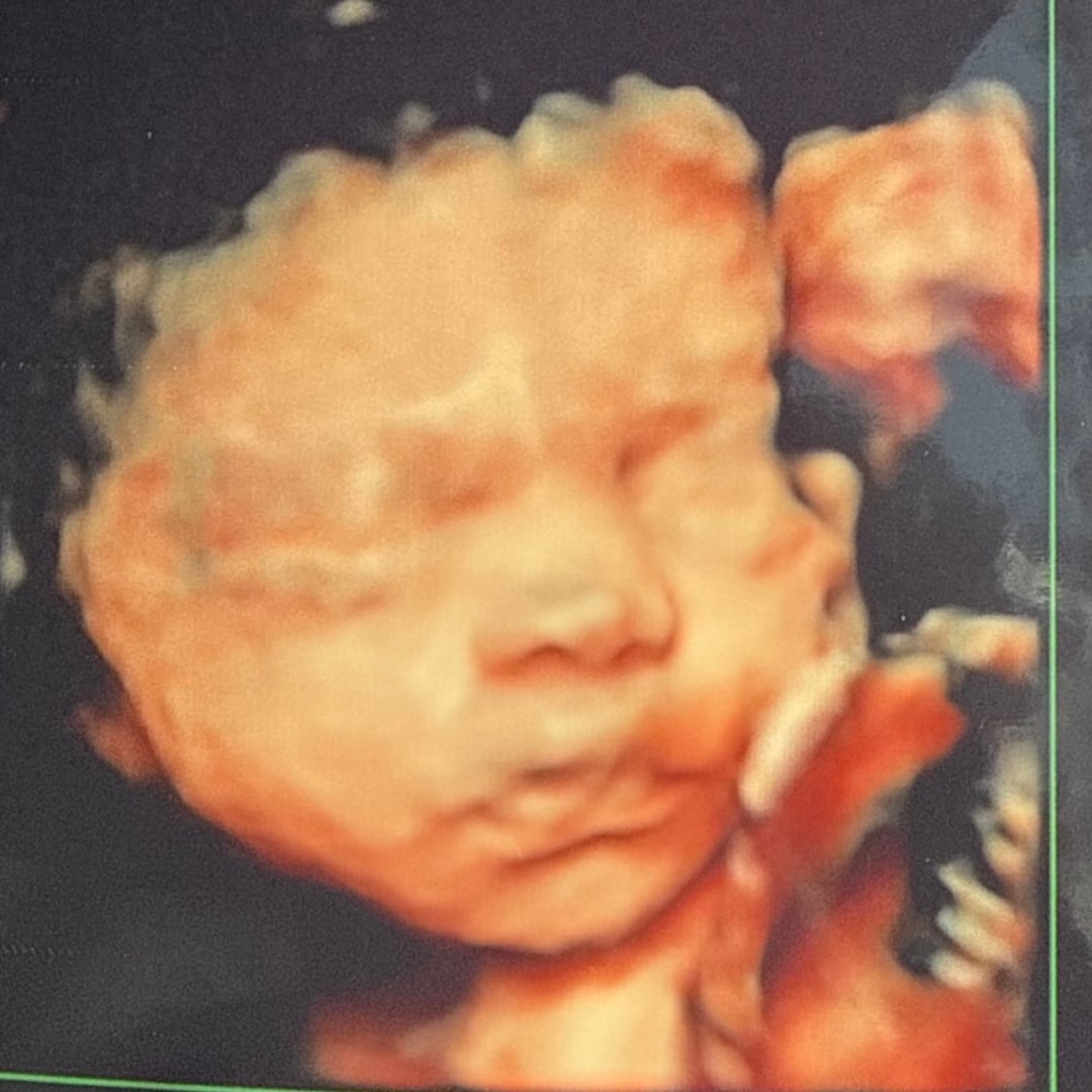 Photo shared by Hannah for their Babylist baby registry.