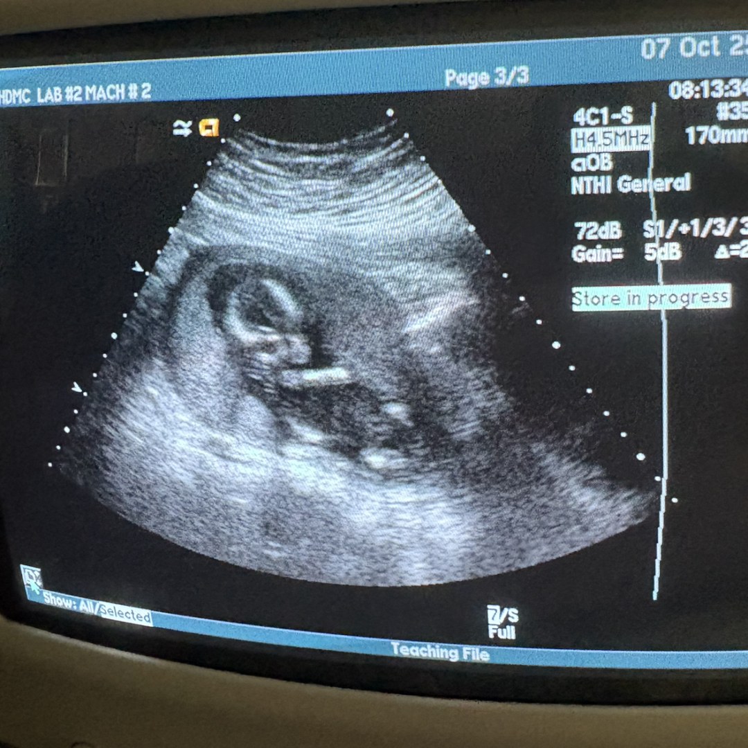 Photo shared by Anahi for their Babylist baby registry.